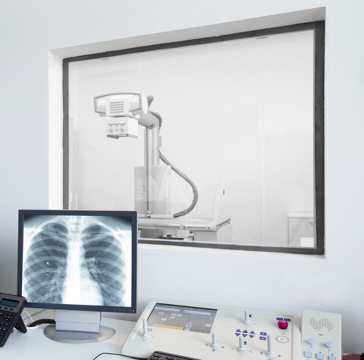 Radiografía de columna el método principal para diagnosticar la osteocondrosis. 