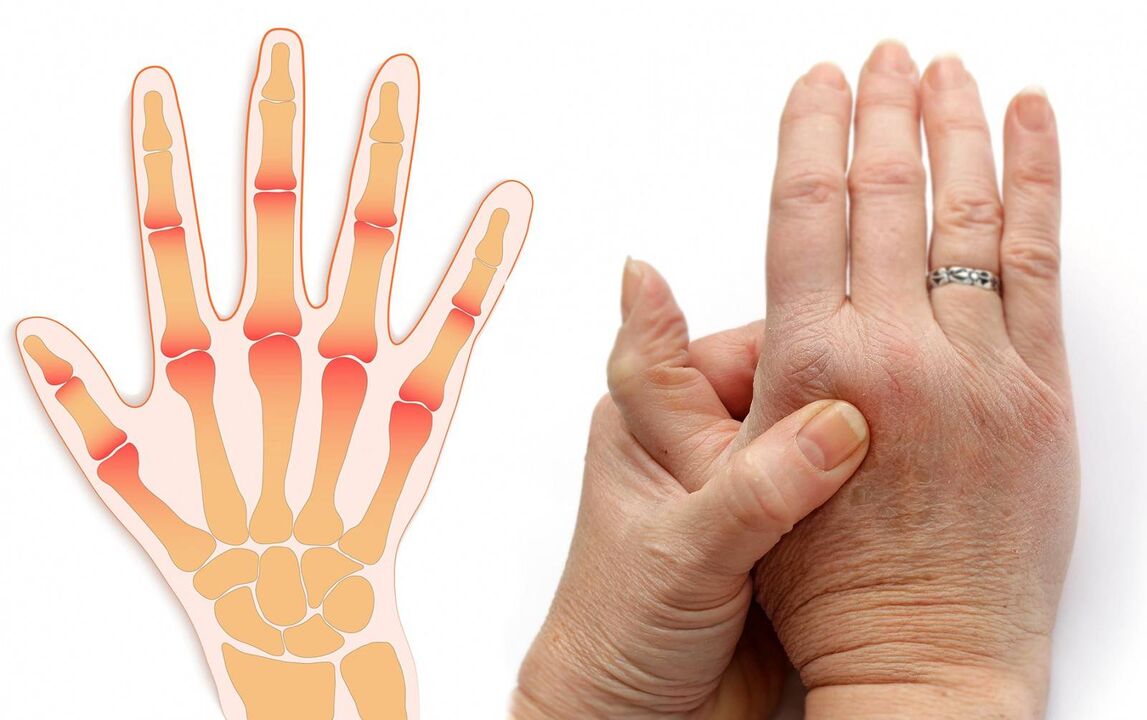 enfermedades de los dedos