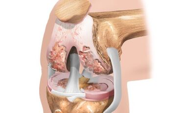 Esquema de los ligamentos