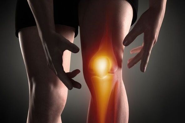 Artrosis de la articulación de la rodilla