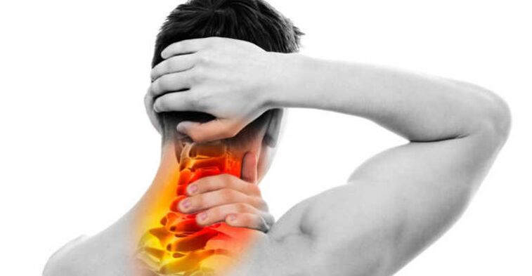 Dolor en el cuello y los signos de la osteocondrosis