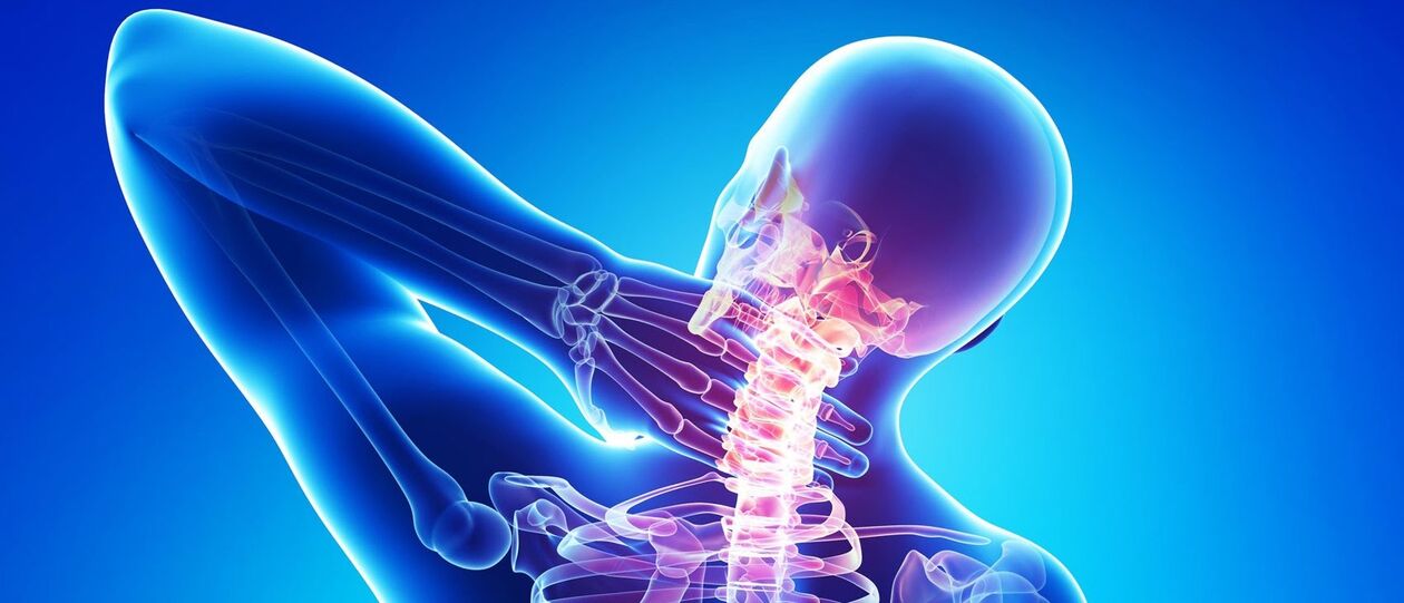 La osteocondrosis cervical es un proceso patológico en el área de la columna vertebral