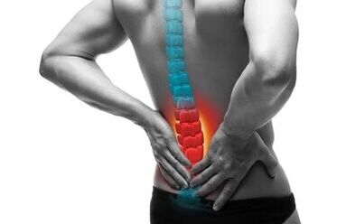 La osteocondrosis es una enfermedad de la columna.