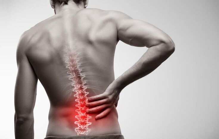 dolor lumbar debido a la osteocondrosis